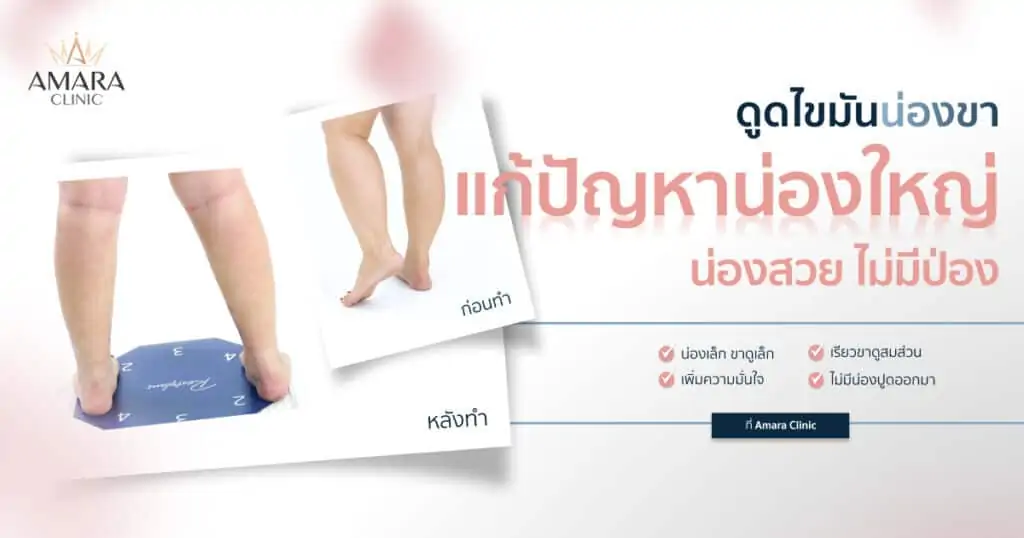 ดูดไขมัน เติมไขมัน Amara Liposuction Center (เอมาร่า คลินิก) โดยแพทย์ผู้มีประสบการณ์
