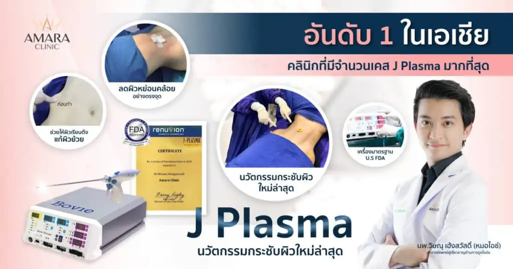 J plasma