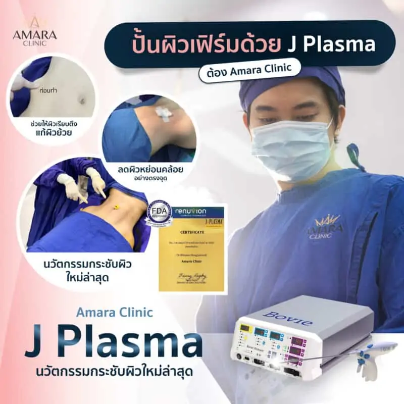 j plasma