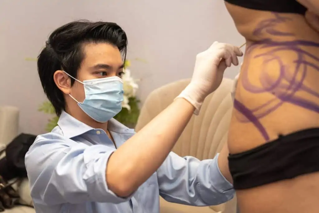 ดูดไขมัน เติมไขมัน Amara Liposuction Center (เอมาร่า คลินิก) โดยแพทย์ผู้มีประสบการณ์