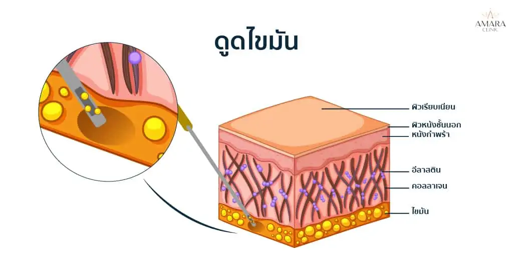 j plasma คือ