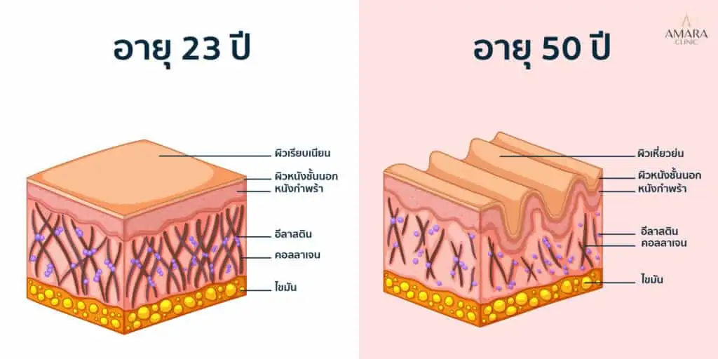 j plasma คือ