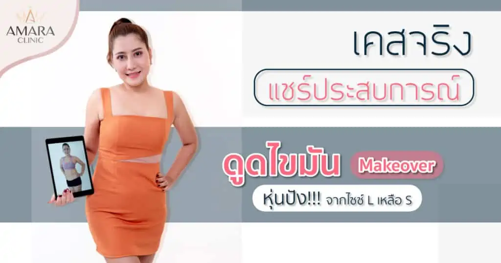 รีวิวดูดไขมัน