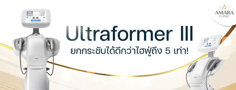 Ultraformer III