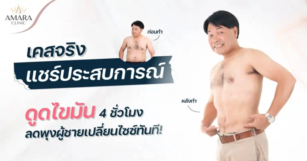 ลดไขมันหน้าท้องผู้ชาย