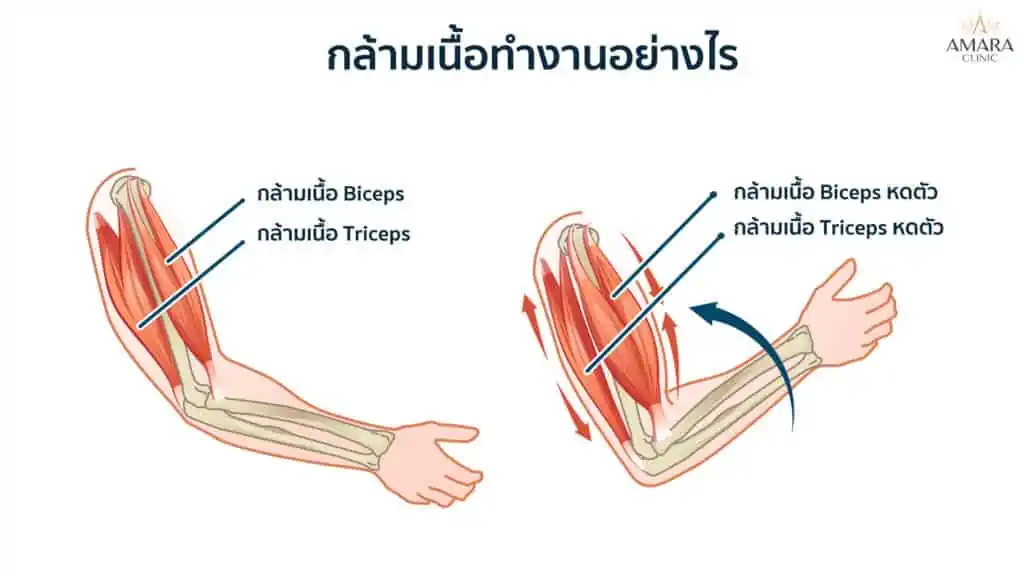 เล่นกล้ามแขน