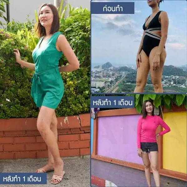 ลดหุ่นหลังคลอด