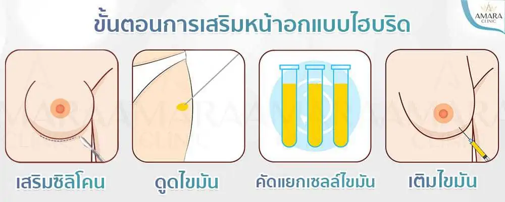 อกใหญ่ทันใจ