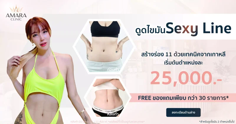 ดูดไขมัน Sexy line ราคา