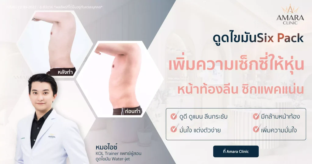 ดูดไขมันซิกแพค สร้างกล้ามหน้าท้องเฟิร์ม & ลีน