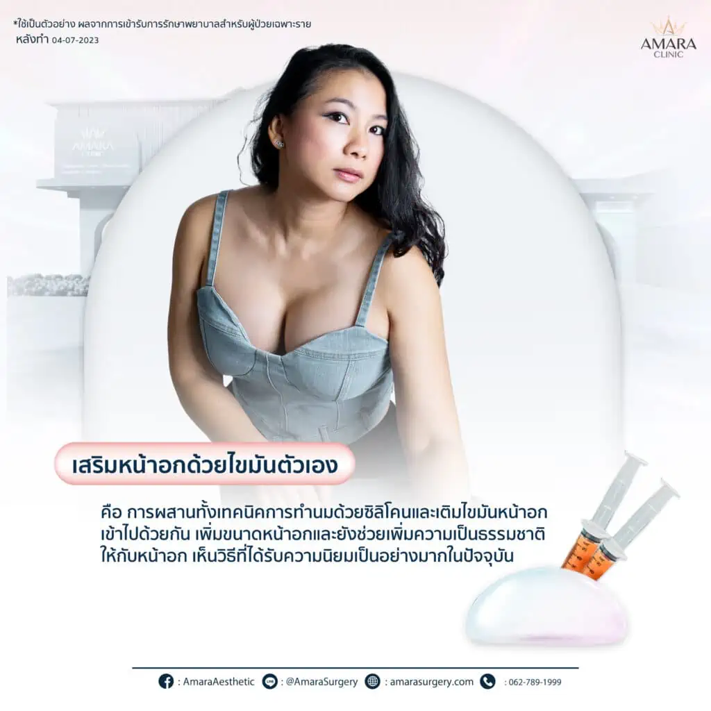 คัพหน้าอกผู้หญิง - amara clinic