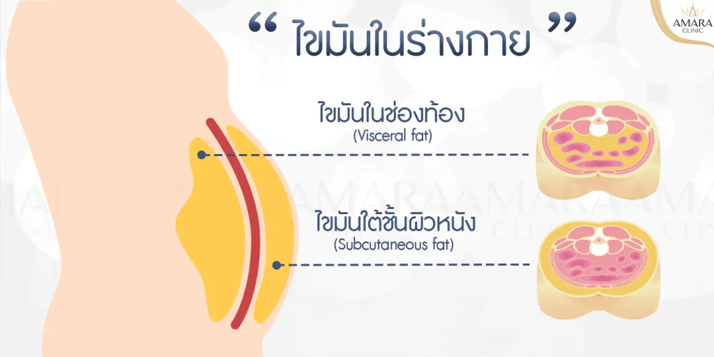 ปากกาลดความอ้วน