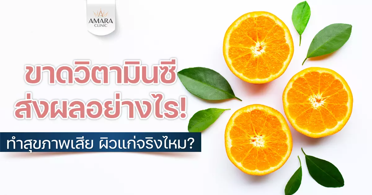 ขาดวิตามินซี ส่งผลอย่างไร! ทำสุขภาพเสีย ผิวแก่ก่อนวัยจริงไหม?