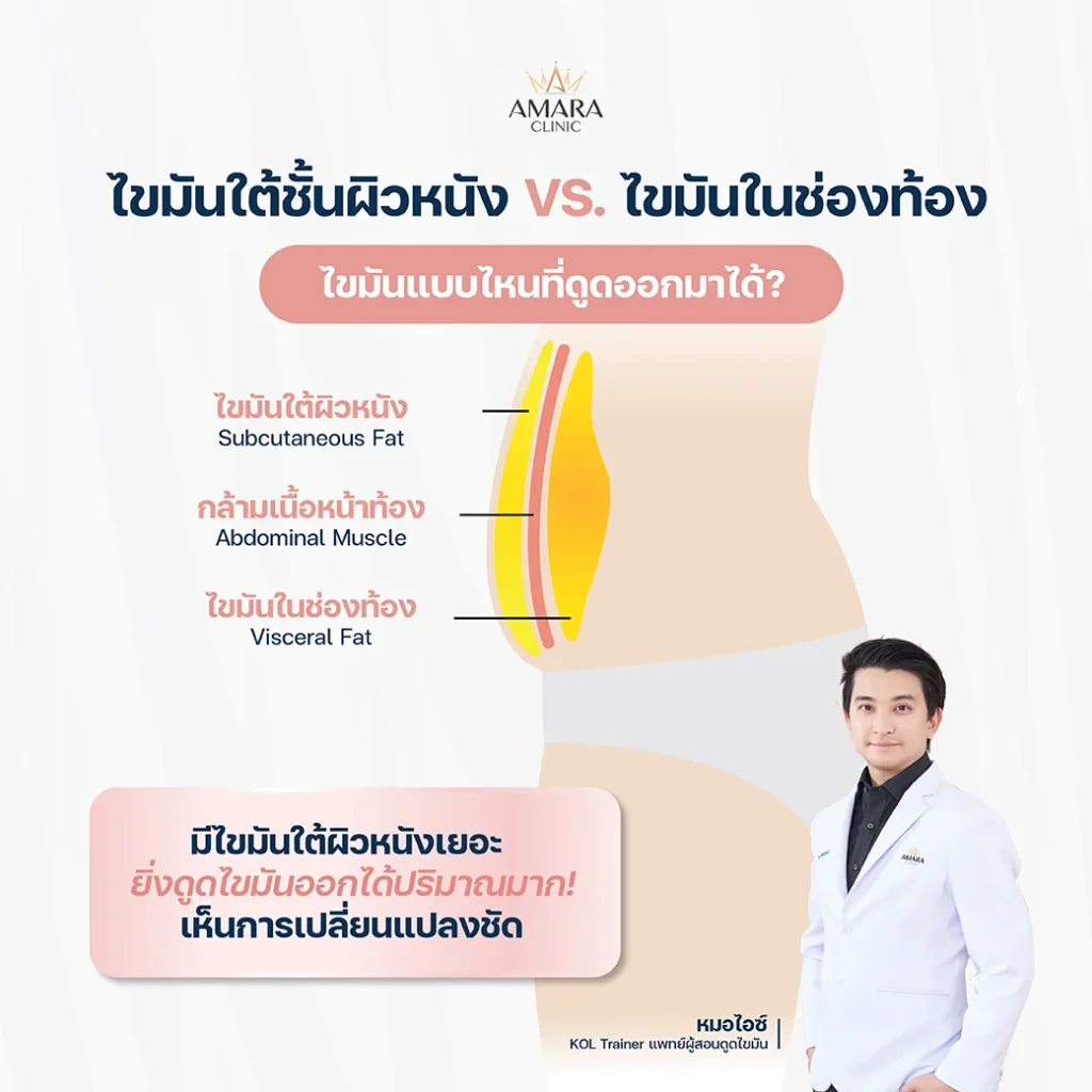 ไขมันใต้ชั้นผิวหนัง VS. ไขมันในช่องท้อง