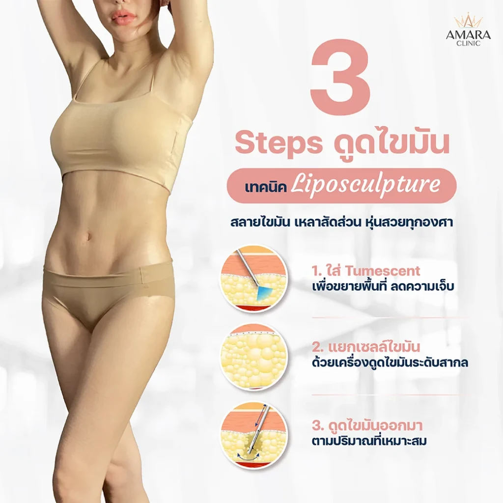 ขั้นตอนดูดไขมัน (Liposuction)