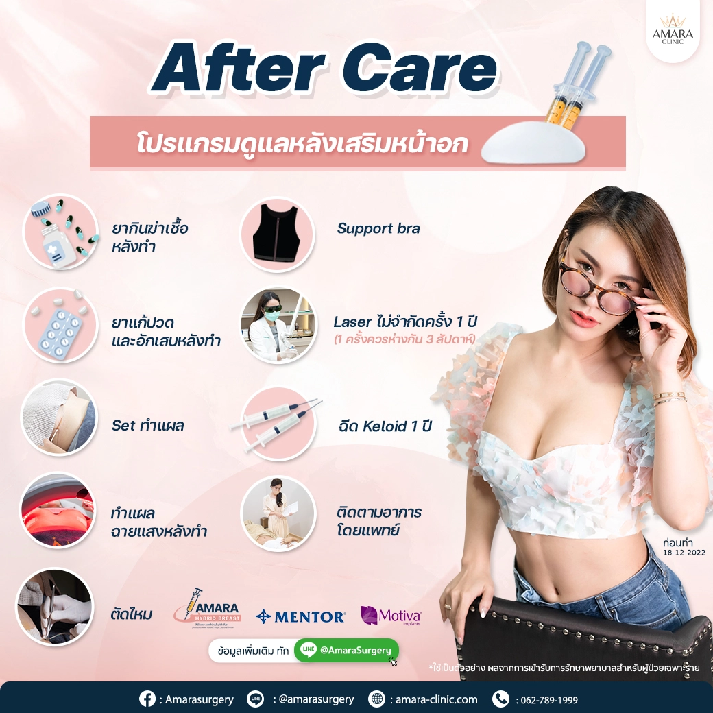 after care after breast augmentation