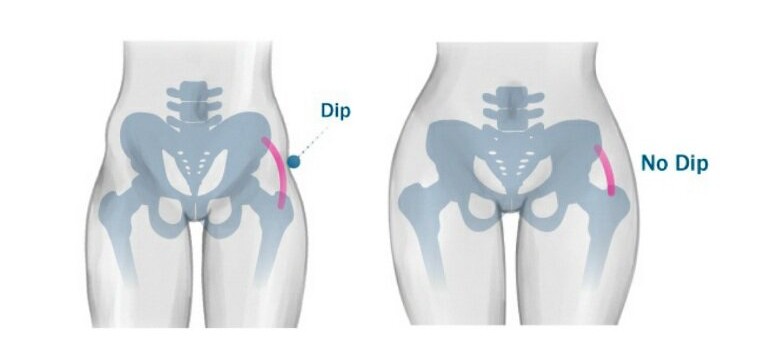 Hip Dip’s bones structure