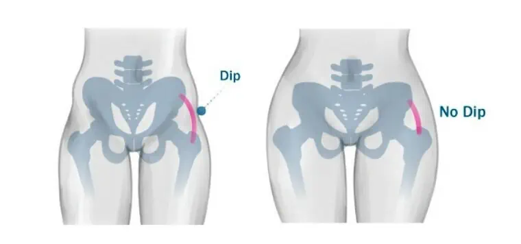 Hip Dip’s bones structure