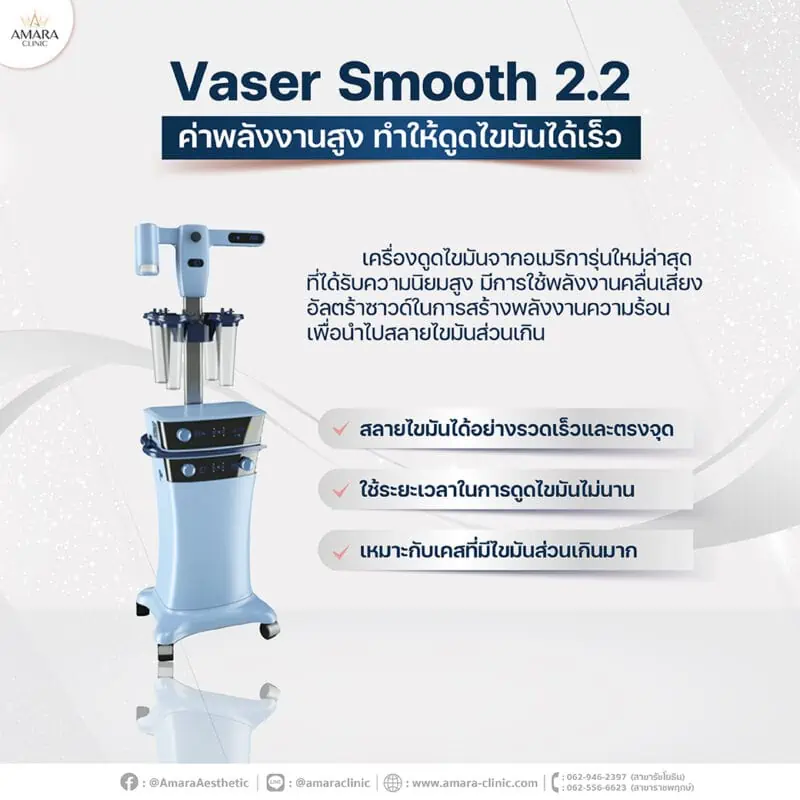 เครื่องดูดไขมัน vaser smooth2.2