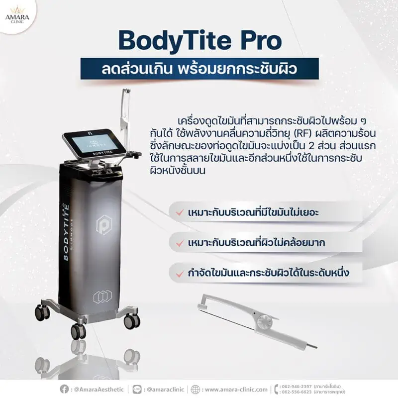 เครื่องดูดไขมัน bodytite pro