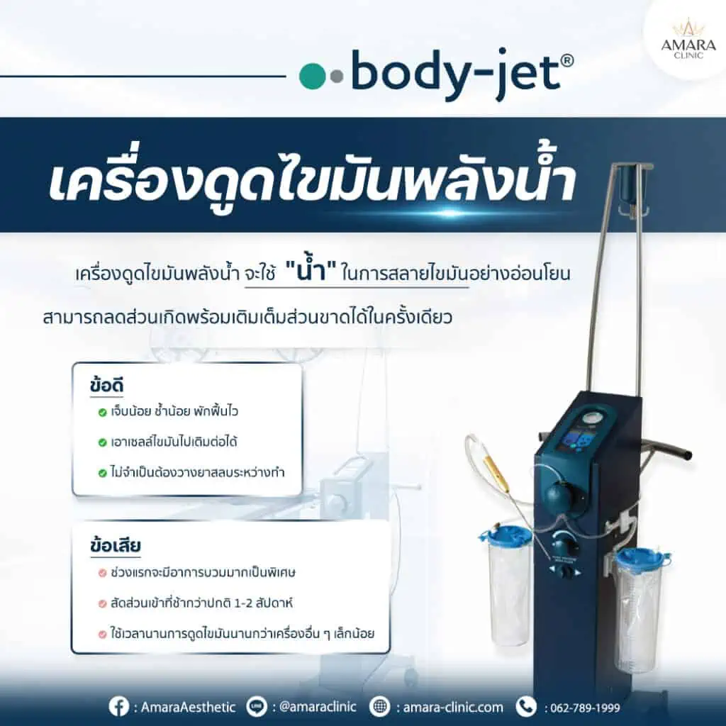 เครื่องดูดไขมัน body-jet