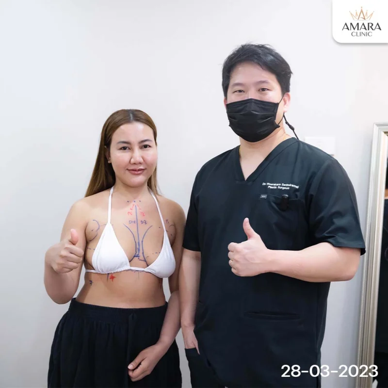 breast augmentation mentor review