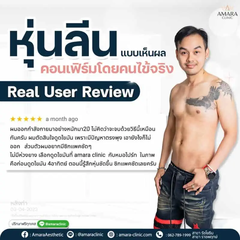 ดูดไขมันหน้าท้องชาย