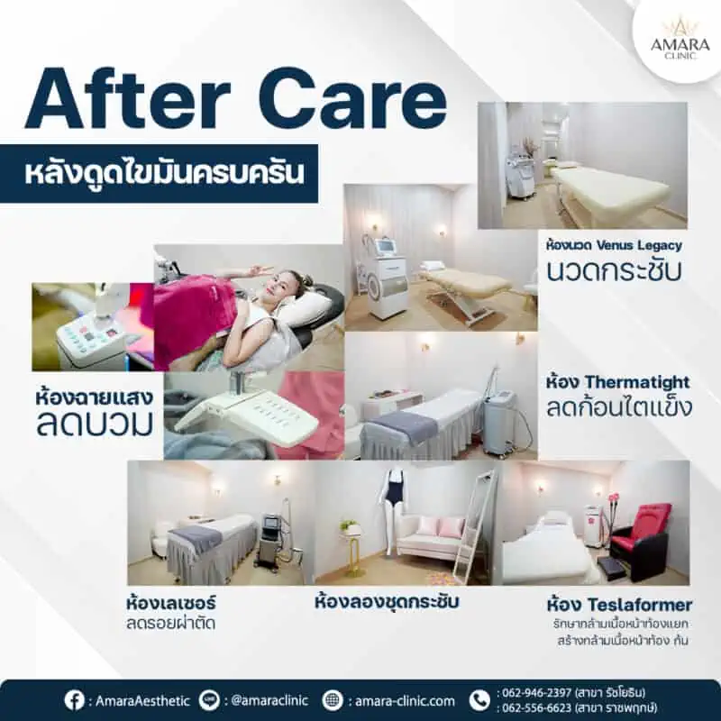 After care หลังดูดไขมัน