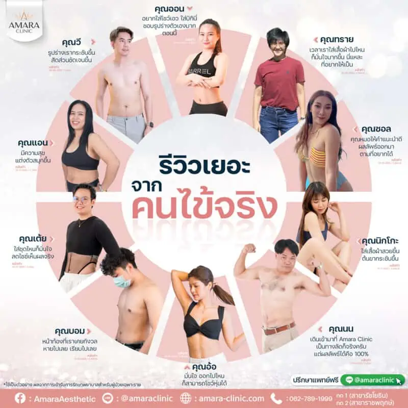 ดูดไขมัน (Liposuction) ที่ amara clinic