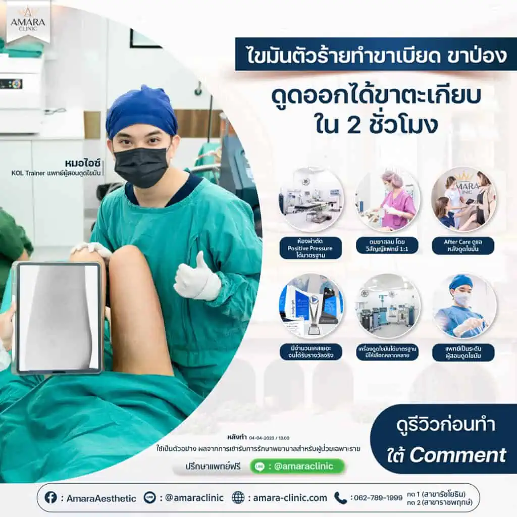 ดูดไขมันน่อง - amara clinic