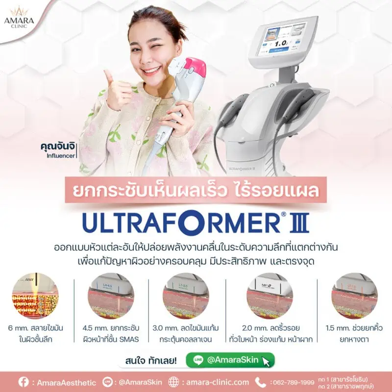 ultraformer iii ทำที่ไหนดี