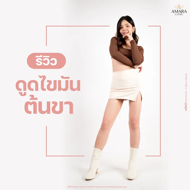 รีวิวดูดไขมันต้นขา