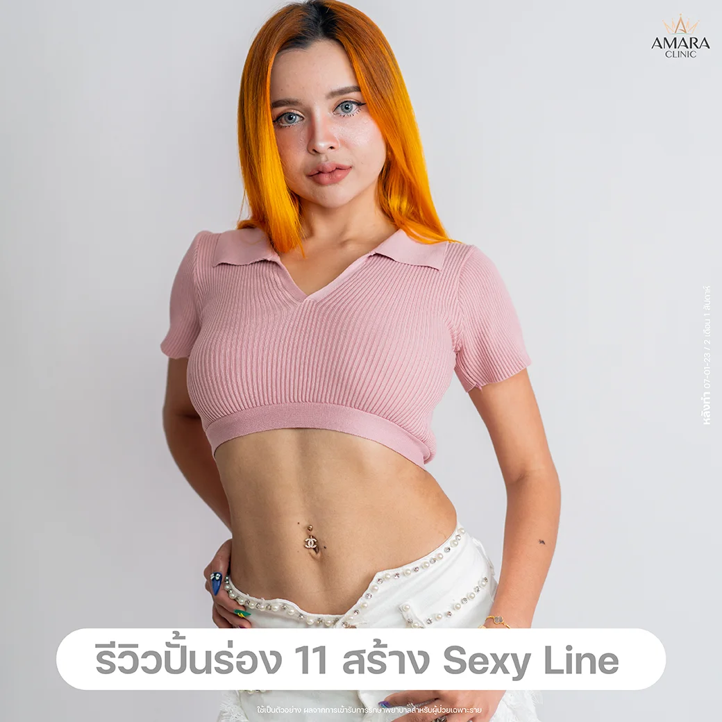 รีวิว ดูดไขมัน sexy line