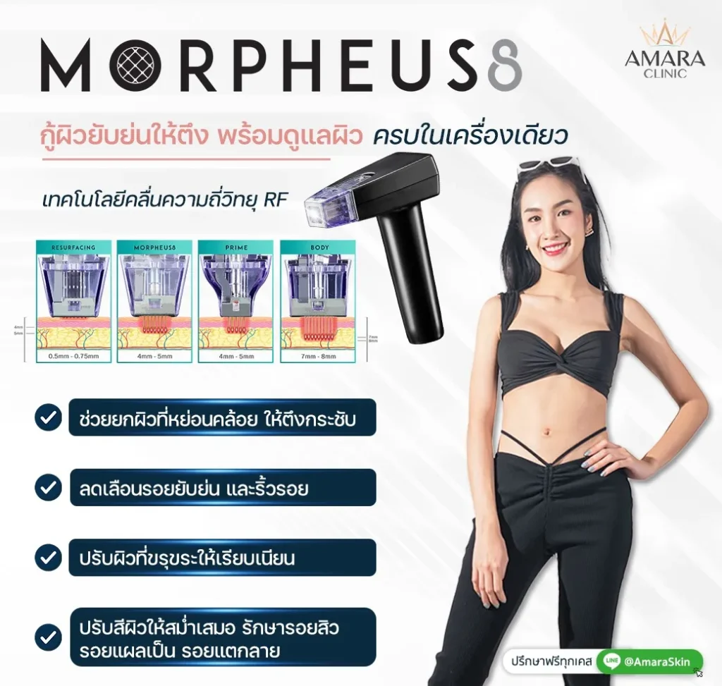 ยกกระชับผิวด้วย Morpheus8