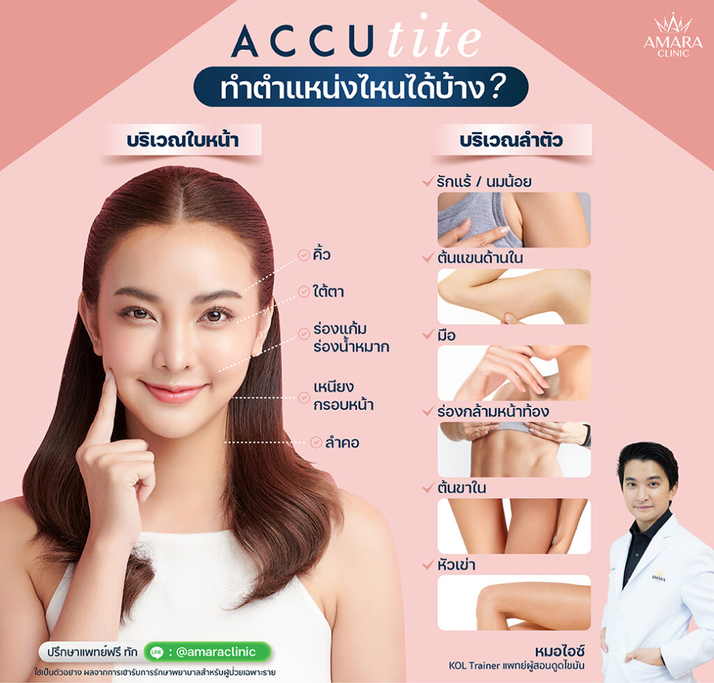 ตำแหน่ง ACCUtite