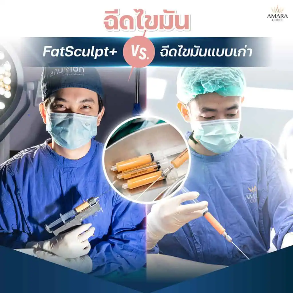 ฉีดไขมัน FatSculpt+ VS ฉีดไขมันแบบเก่า