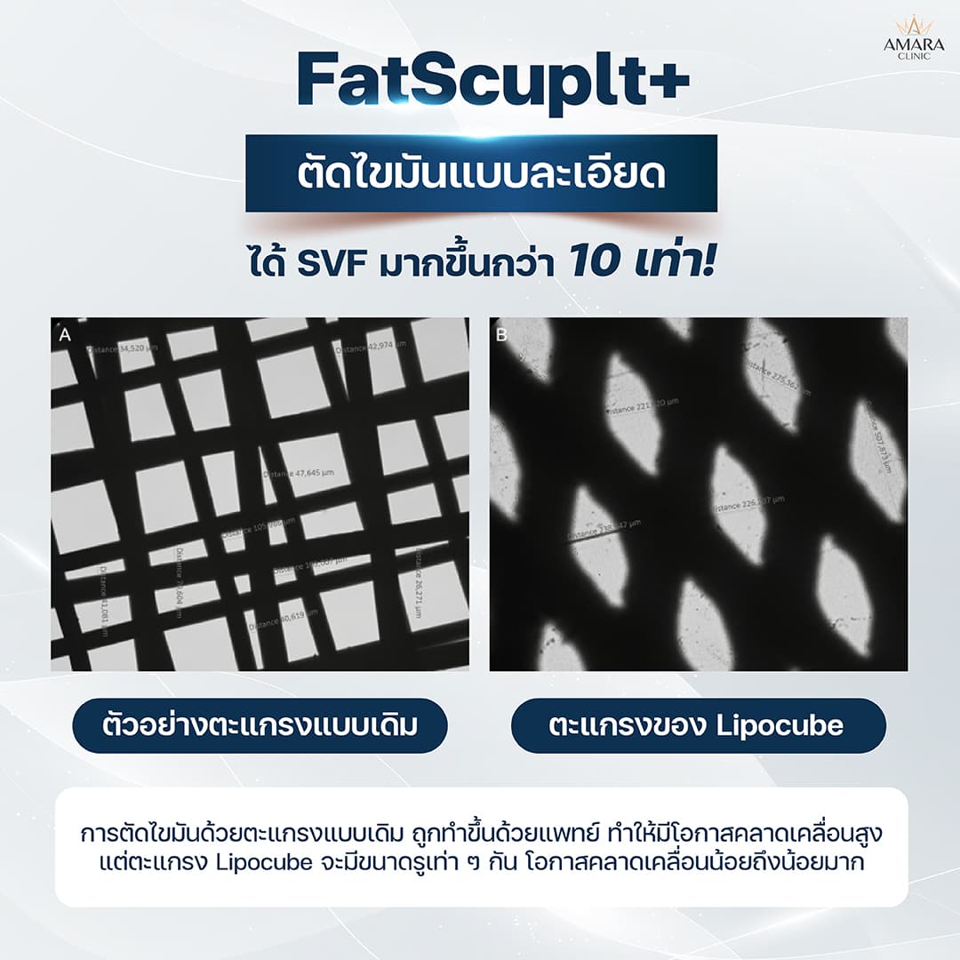 Old Fat Grafting VS FatScuplt+ Techniqu