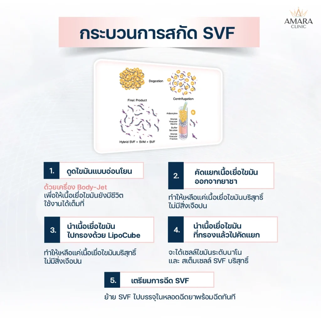 SVF’s extraction process