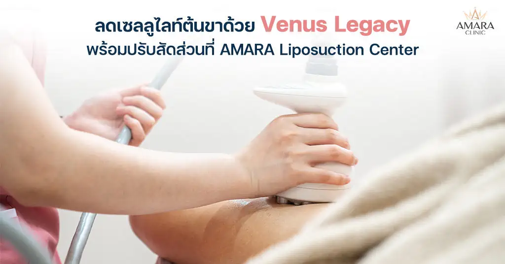 ลดเซลลูไลท์ต้นขาด้วย Venus Legacy