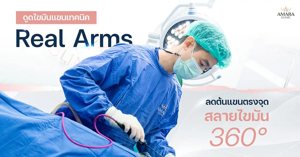 ดูดไขมันต้นแขน เทคนิค Real Arms