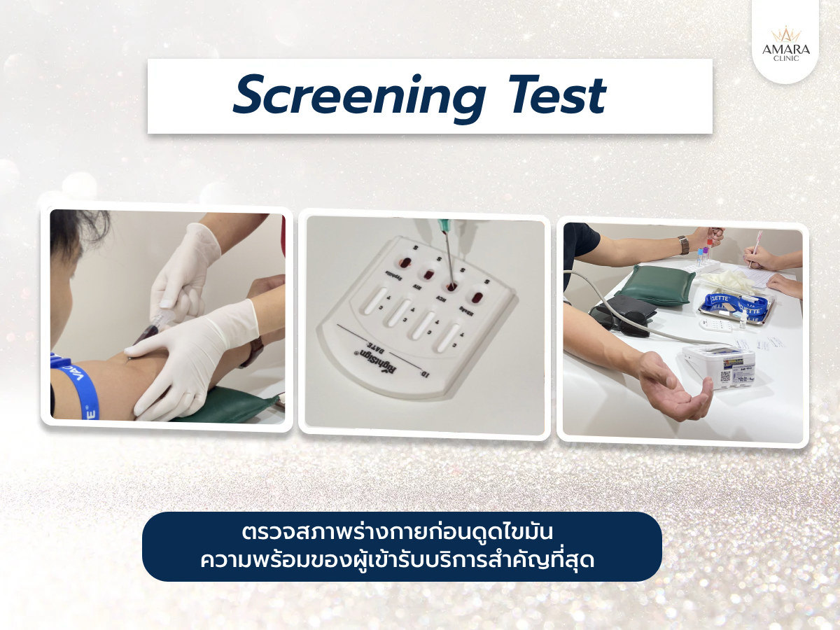 Screening Test ก่อนดูดไขมัน