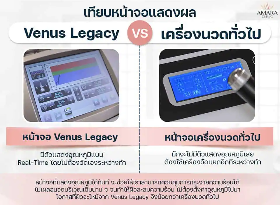 หน้าจอแสดงผล Venus Legacy และเครื่องนวดทั่วไป