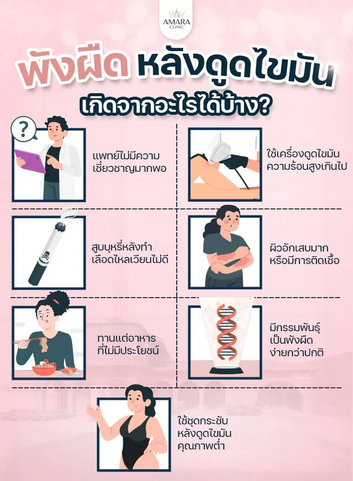 สาเหตุของการเกิดพังผืดหลังดูดไขมัน