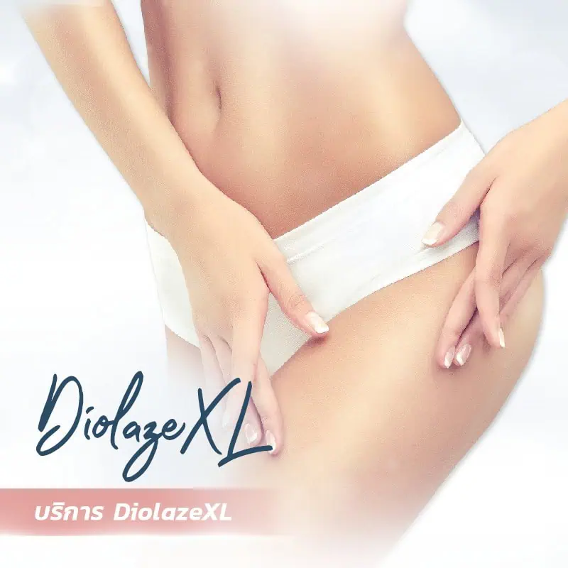 DiolazeXL