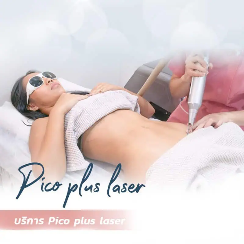 Pico plus laser