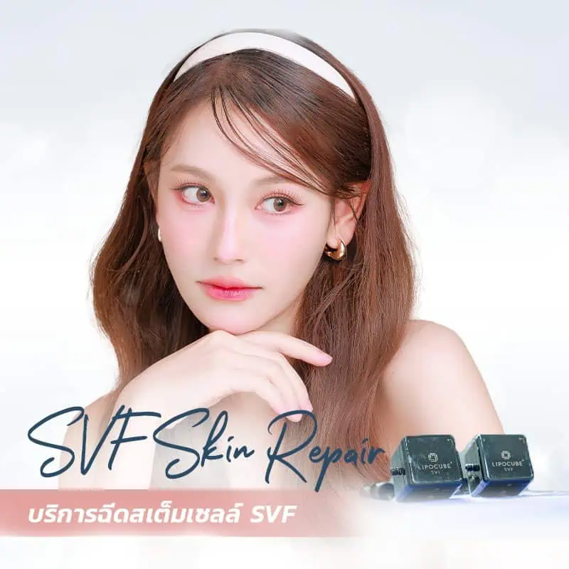 SVF