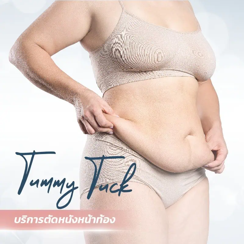 tummy-tuck