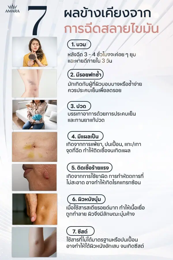 ฉีดสลายไขมัน ผลข้างเคียง