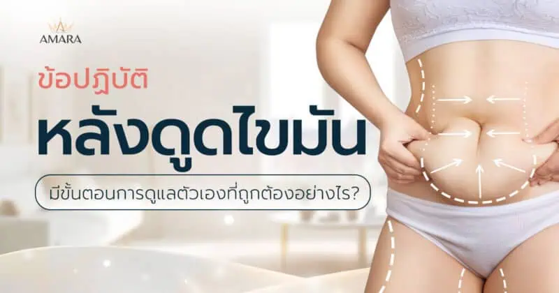 ข้อปฏิบัติหลังดูดไขมัน