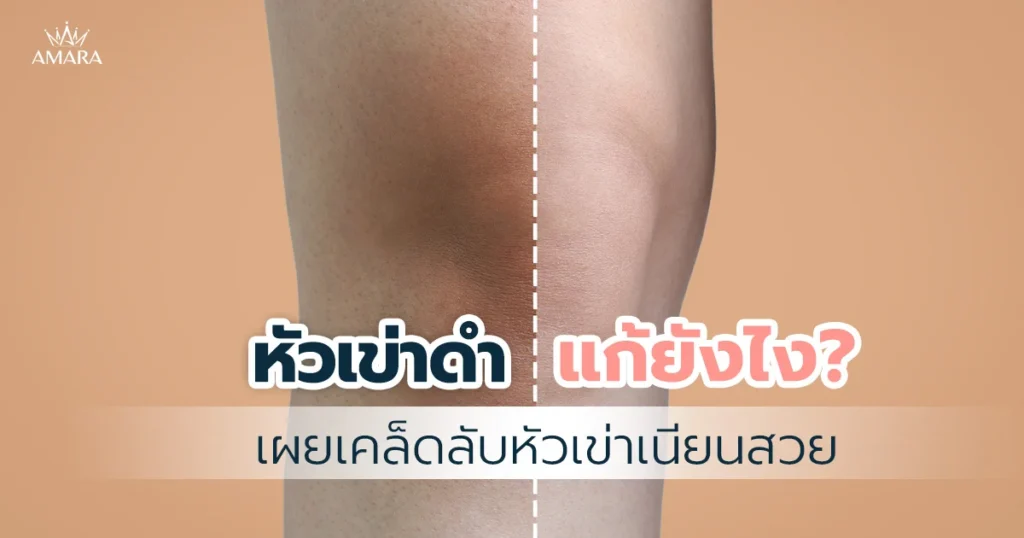 knee-whitening-tips